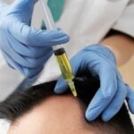 high angle man getting prp treatment premium photo