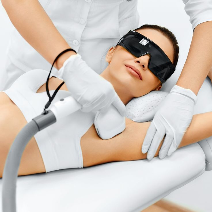 laser hair removal