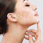 thread lifts 60 minute facelift thread lift kent elite aesthetics