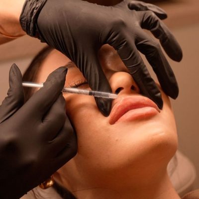 lip filler brisbane